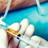18 років тому Нідерланди першими у світі легалізували евтаназію